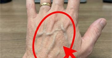 516441890 122198327888450537 3836375363348464176 n 617 51 768x780