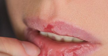 565145045 1370337034661835 1510974072288335963 n 768x960