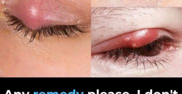 582417284 122103533379105708 3901676824132851413 n 1 768x960