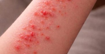 648836742 122232229310271956 8802968970652089123 n 768x1152