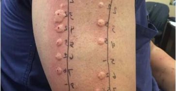 Estas son las consecuencias de acostarse con