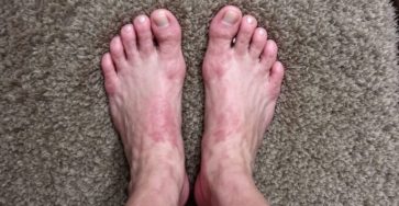 Pies hinchados salon 768x439