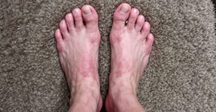 Pies hinchados salon 768x439