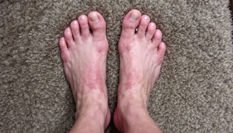 Pies hinchados salon 768x439